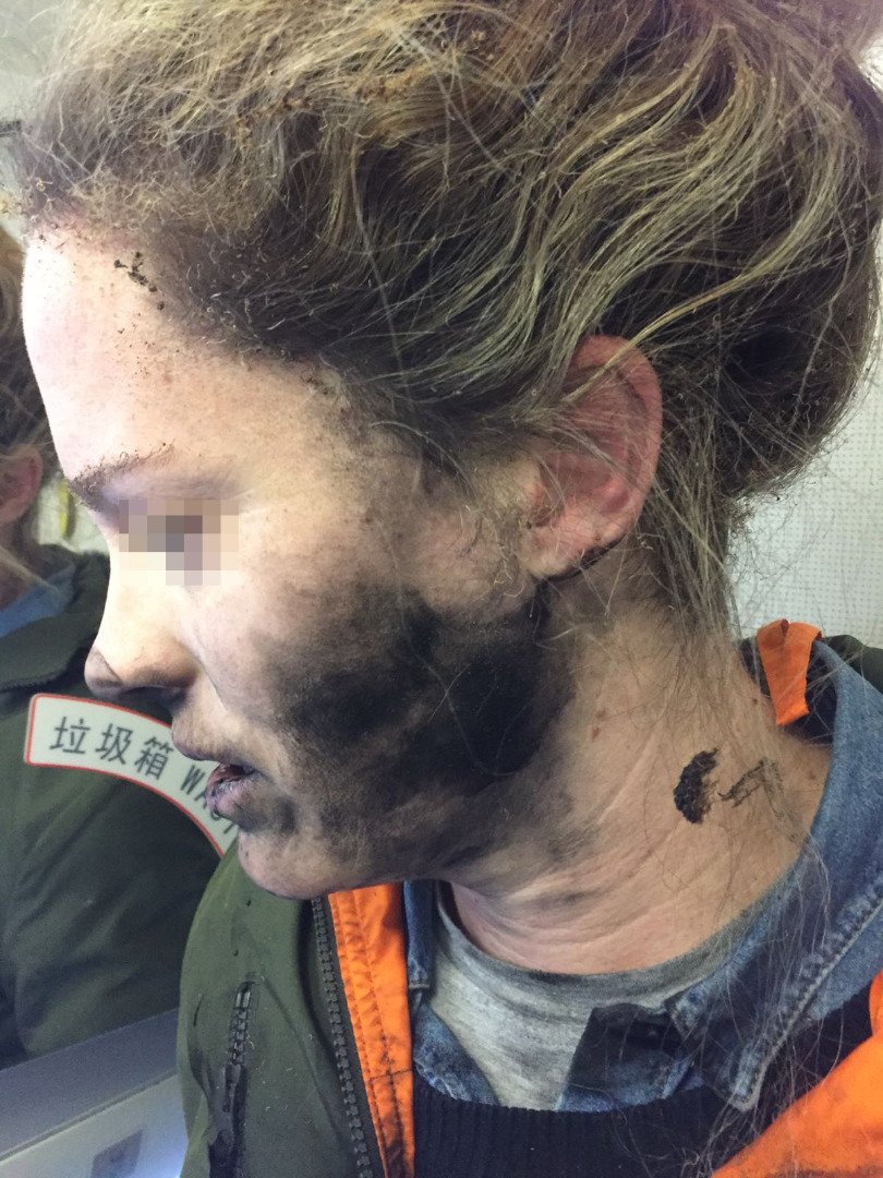Foto des rußgeschwärzten Kopfes der Frau nach der Explosion der Kopfhörer