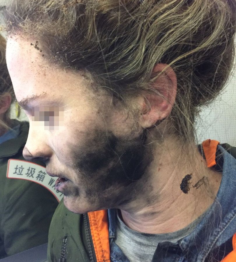 Foto des rußgeschwärzten Kopfes der Frau nach der Explosion der Kopfhörer