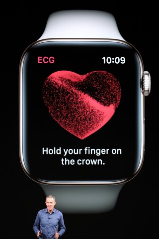 Es fehlen laut einer Kardiologin noch wichtige Zusatzinformationen und Tests, um die Apple Watch empfehlen zu können.
