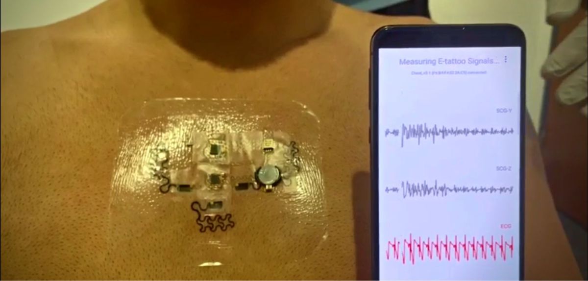 Smartphone zeigt EKG neben dem E-Tattoo der University of Texas at Austin