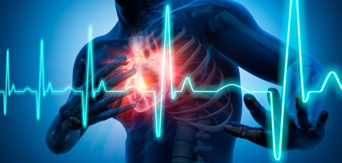 Grafische Darstellung eines Herzinfarktes mit einer Person, die sich an die Brust greift.