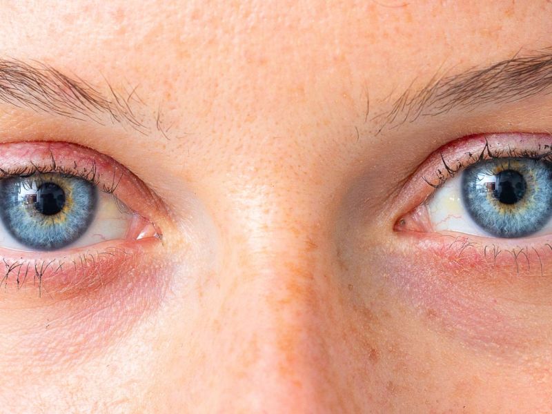 Frau mit blauen Augen.