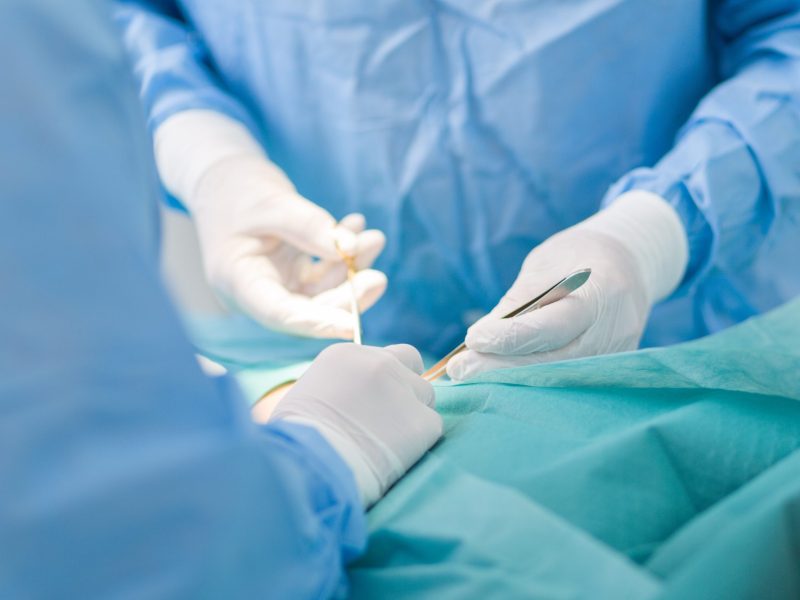 Nahaufnahme auf eine medizinische Operation. Menschen in blauen Kitteln und weißen Handschuhen halten Op-Werkzeuge