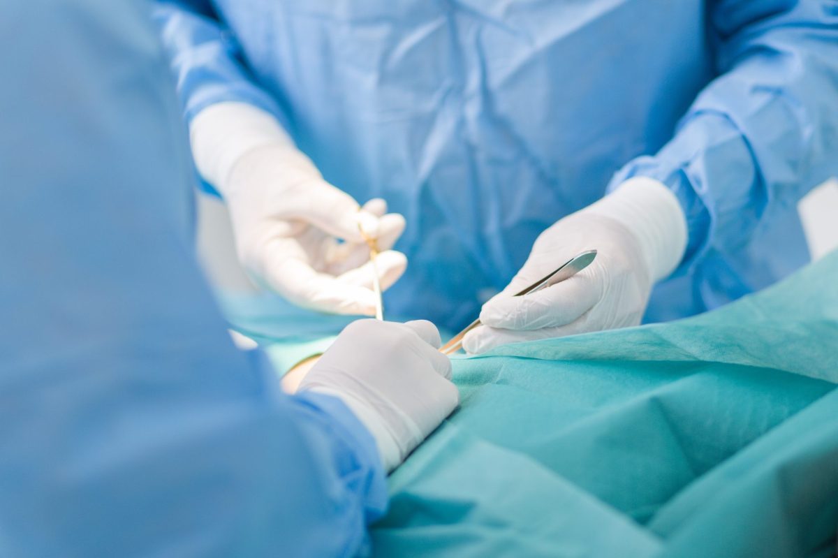 Organtransplantation: Forscher sind schockiert – gruseliger Nebeneffekt entdeckt